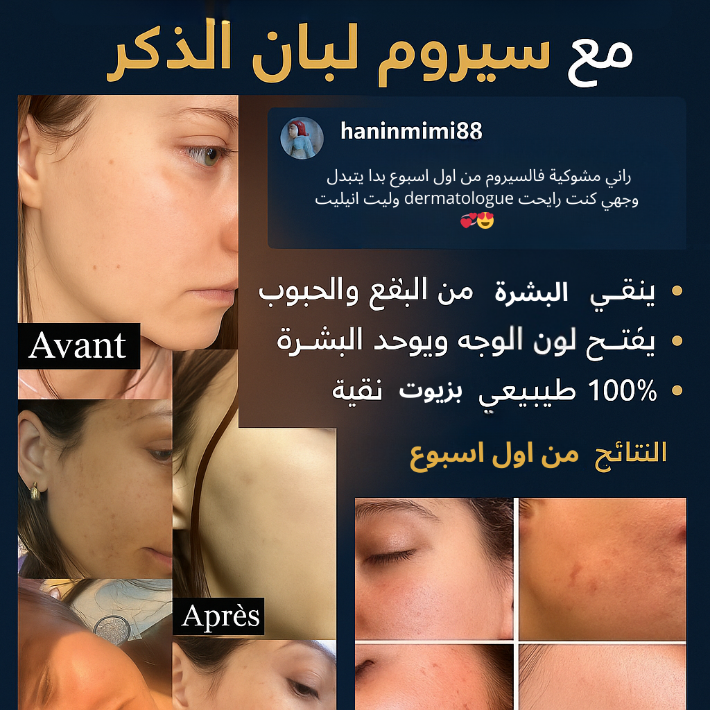 🌿 سيروم لبان الذكر الطبيعي %100